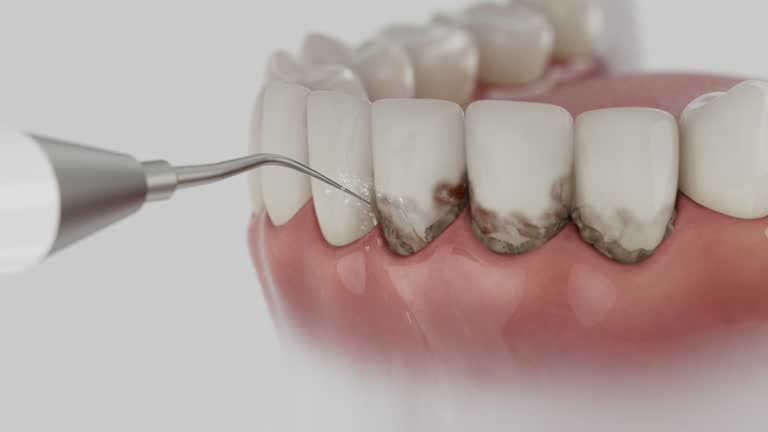 Reliable Dental Implants contractor in Durango, CO by Smile Center Dentistry